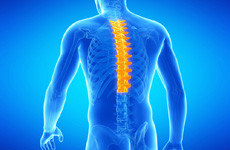 Защемление нерва в спине. Поможет ли МРТ спины?