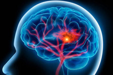 Что показывает МРТ сосудов головного мозга?