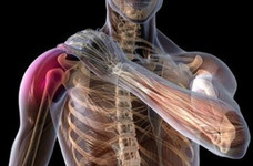 Артроз плечевого сустава - редкая и опасная болезнь